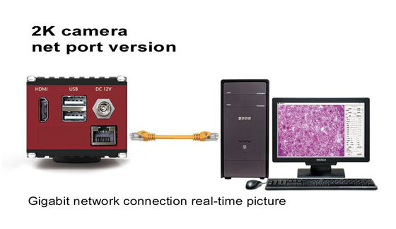 Цифровая фотокамера микроскопа HDMI 60FPS с сетевым интерфейсом гигабита